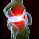 osteoarthritis